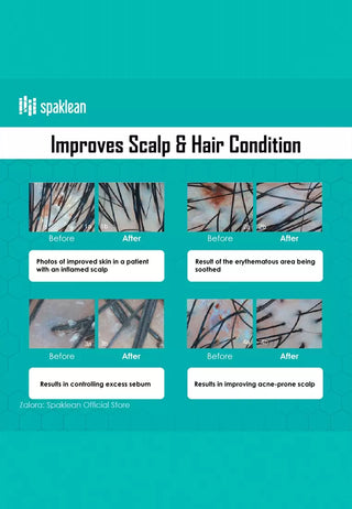 سباكلين - علاج الكولاجين المائي المذهل - 300 مل